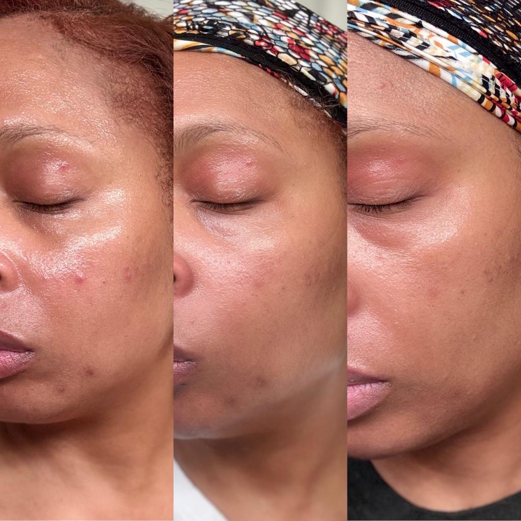 Seamoss, turmeric Shea butter face and body bar